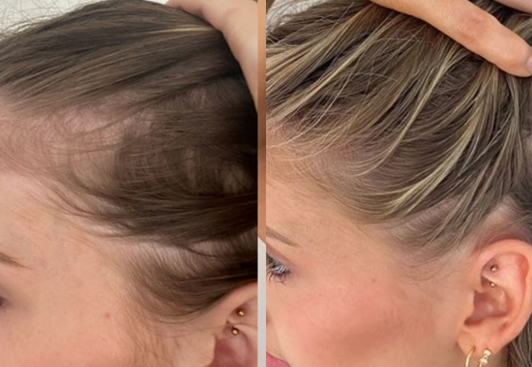 Best Hair Growth Spray Products EZZ OFFICIAL