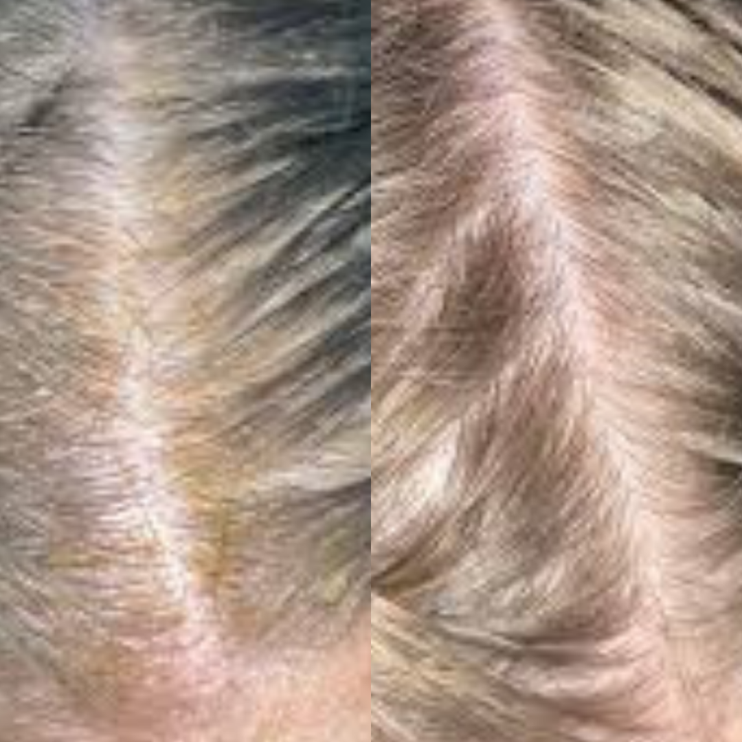 Best Hair Growth Spray Products EZZ OFFICIAL