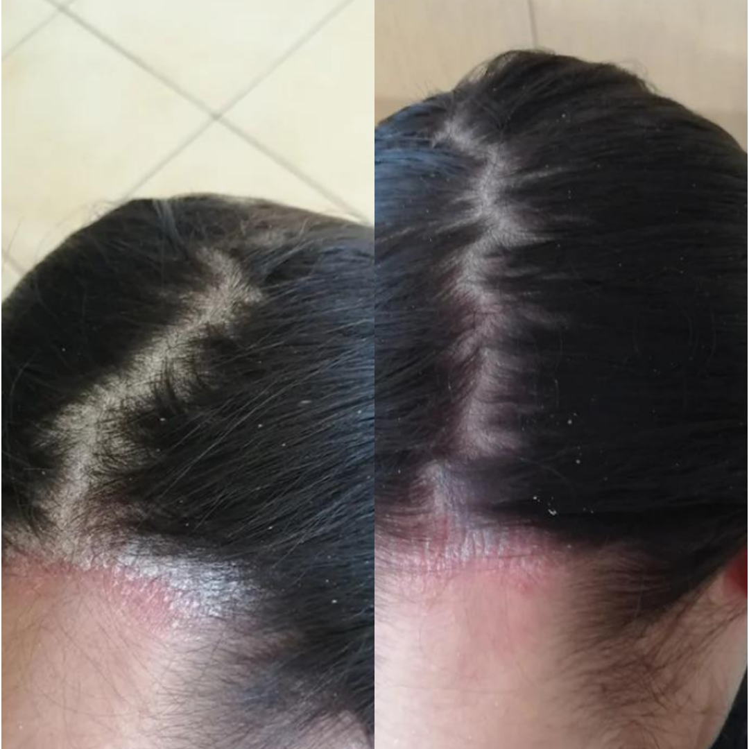 Best Hair Growth Spray Products EZZ OFFICIAL