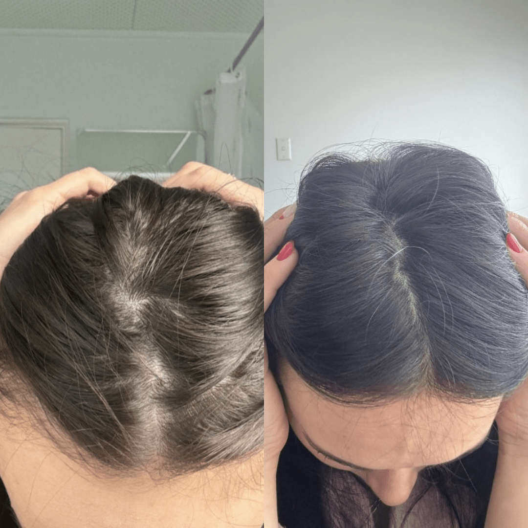 EZZ Hair Growth Spray DUO - Best Hair Growth Spray Products EZZ OFFICIAL